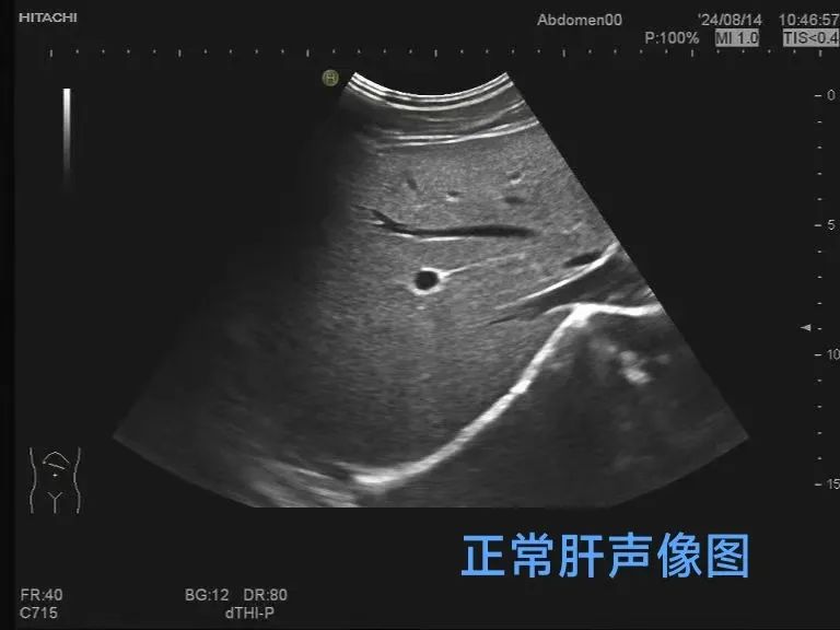 cd8cce8d5150590c01977ead300b2437.jpg