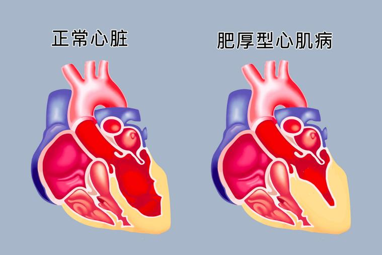1.png 1.png