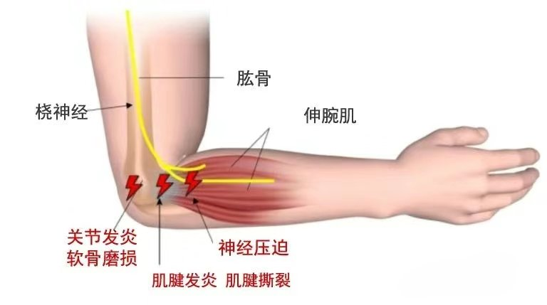 图片1.png 图片1.png