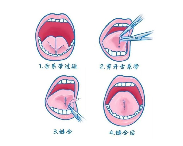 图片5.png 图片5.png
