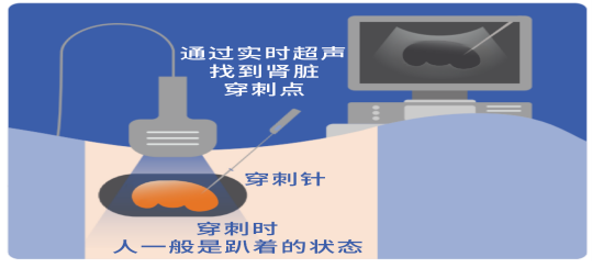 d350d0d0-8b99-4dc2-aa67-3d2e97869a91.png