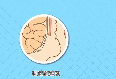 微信图片_20250812171324.gif