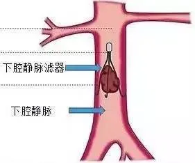 ac3886c07db120a23c708208cd841f44.png