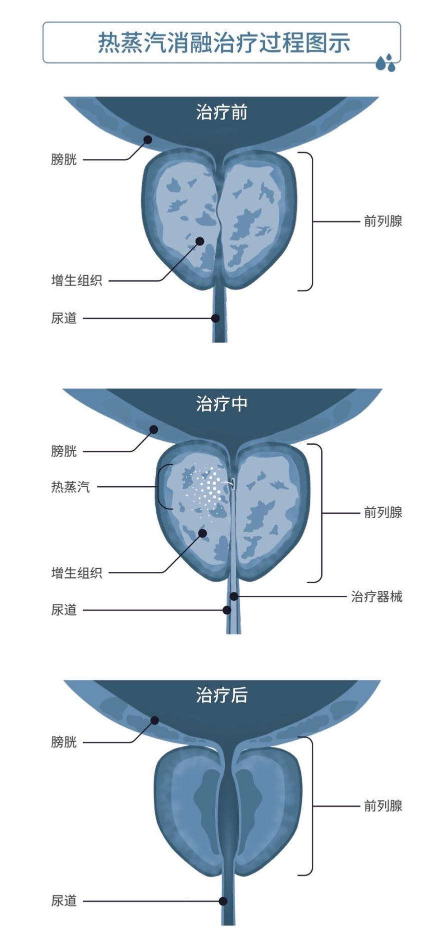 9f1fee536d06c22f7768bd0c8a83e400.png